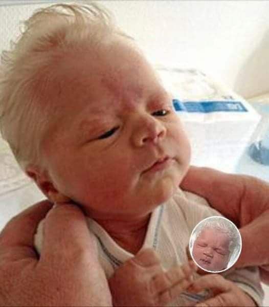 Baby mocked for having white hair – years later, he looks perfectly happy and healthy.