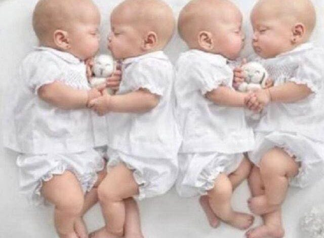 The Identical Quadruplets Have Grown: Here’s How They Look Now.