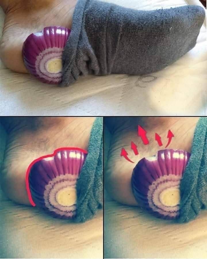 See What Happens When You Put Onion in Your Socks When You Sleep