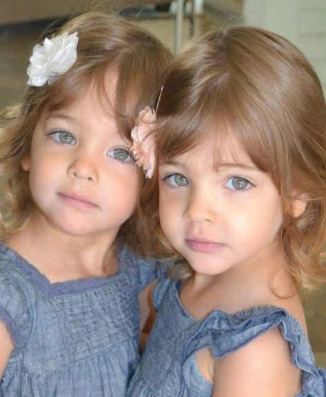 Most beautiful twins in the world’ are now stunning young teens