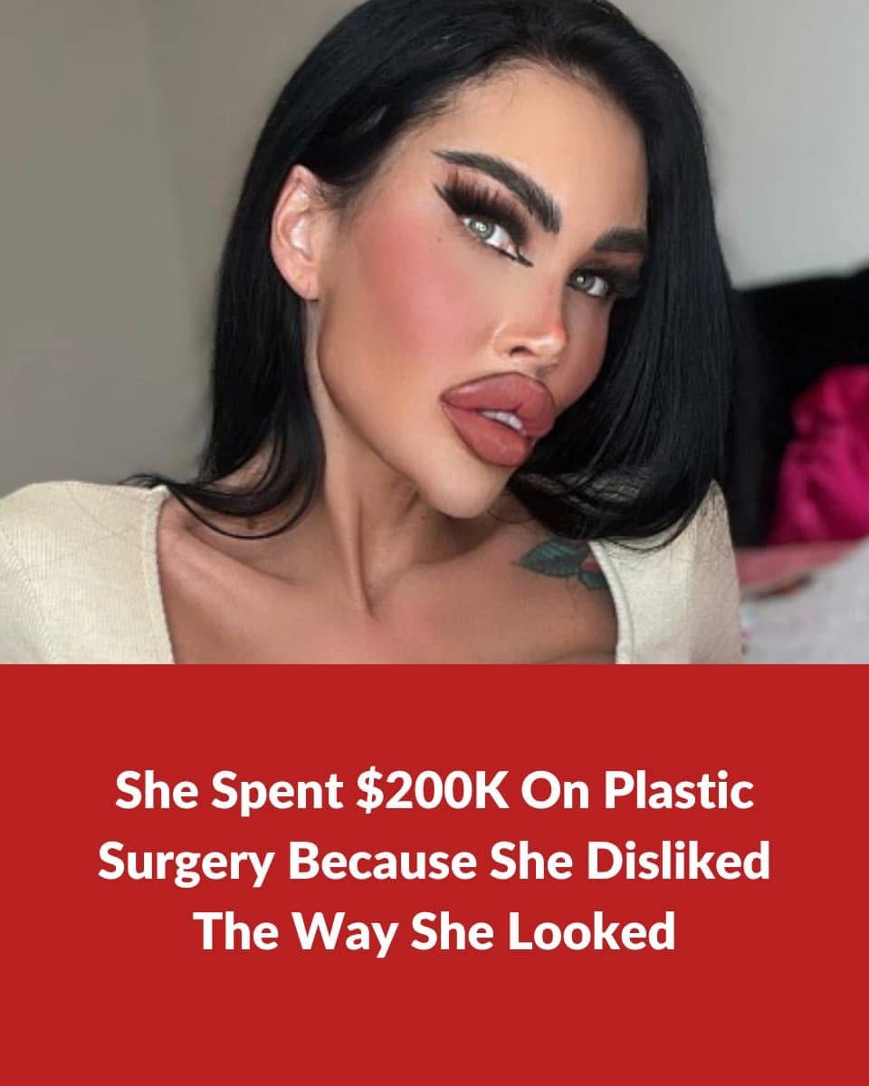 She Spent $200K On Plastic Surgery Because She Disliked The Way She Looked  Pics in comments